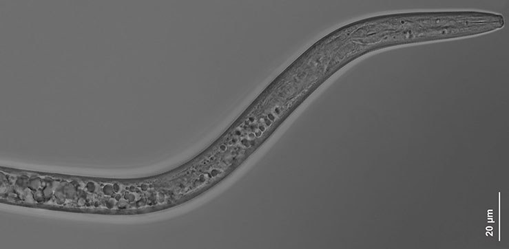 Meloidogyne naasi juvenile anterior end. Allegheny National Forest, PA