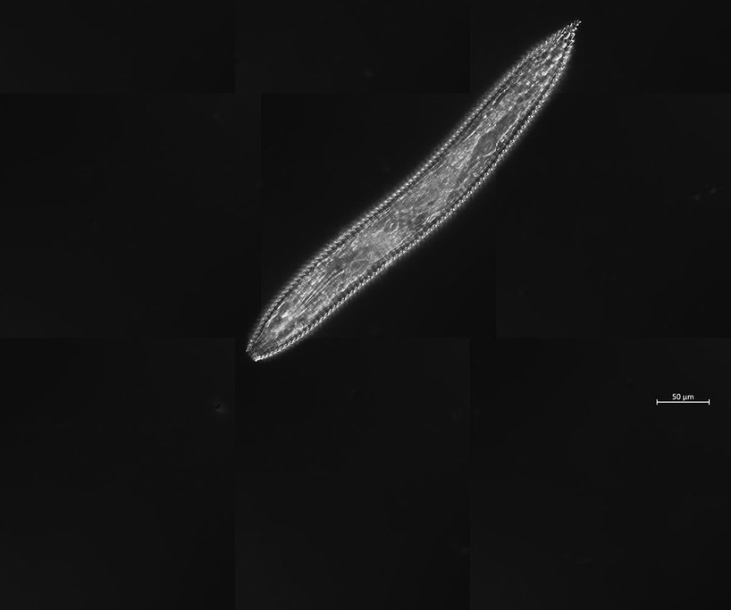 DIC image of a ring nematode from Allgheny National Forest, PA