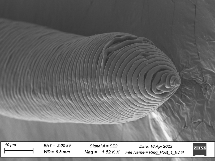 Posterior end SEM images of a ring nematode from Allgheny National Forest, PA