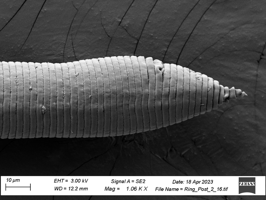 Posterior end SEM image (lateral view) of a ring nematode from Allgheny National Forest, PA