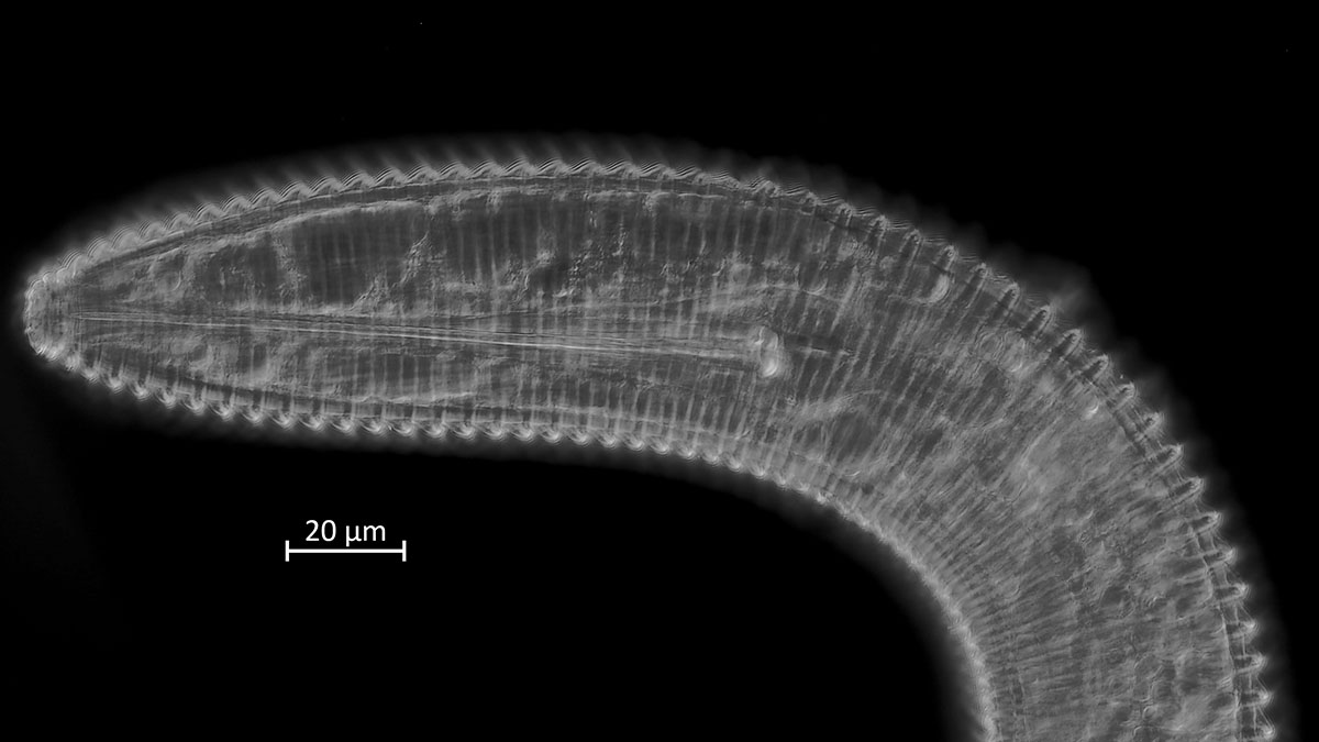 Anterior end DIC image of a ring nematode from Allgheny National Forest, PA