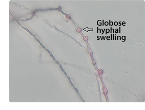 globose hyphal swelling
