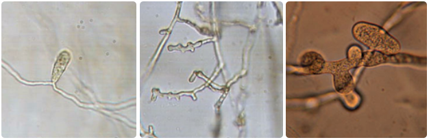 hyphae