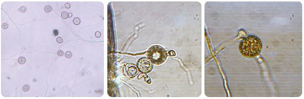 Hyphae have terminal or intercalary(part of the hyphal thread like a bead on a sting) spherical or swollen structures. Some are sporangia and others are oogonia.