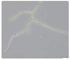 What is Pythium? — Pythium — Department of Plant Pathology and