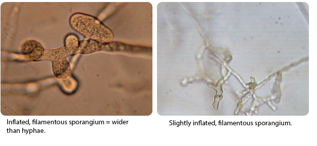 filamentous sporangium
