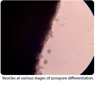 Vesicles at various stages of zoospore differentiation.