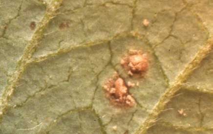 Pustule