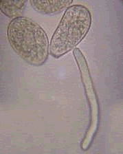 Urediniospores with germ tube